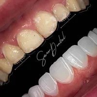 بیا کاخ نیاوران کامپوزیت کن بعدا پرداخت کن
