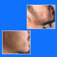 بردپیت شو|آرایشی، بهداشتی، درمانی|تخت سلیمان, |دیوار