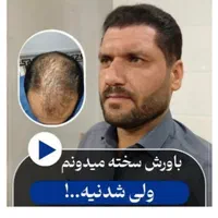 کاشت مو طبیعی شیراز|خدمات آرایشگری و زیبایی|شیراز, قصرالدشت|دیوار