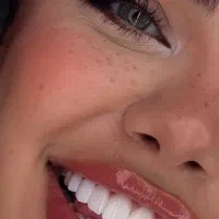 دندان پزشکی کامپوزیت لمینت