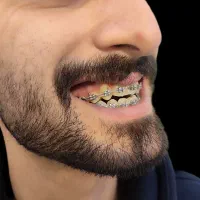 دندان پزشکی|خدمات آرایشگری و زیبایی|رشت, گلسار|دیوار