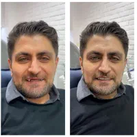 دندانسازی ،دندان مصنوعی ،پنجاه درصدتخفیف|آرایشی، بهداشتی، درمانی|مشهد, پایین خیابان|دیوار