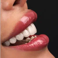 کامپوزیت مونوکروم با قیمت استثنایی هر فک ۵/۹۸۰