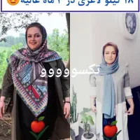 آگهی لاغری|آرایشی، بهداشتی، درمانی|گرگان, |دیوار