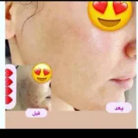 کرم بدن نقره|آرایشی، بهداشتی، درمانی|خاش, |دیوار