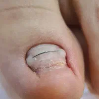 پودولوژی در ساری
