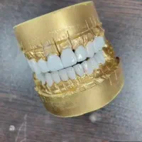 دندانپزشکی کامپوزیت اقسِاطی