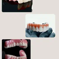 دندان مصنوعی|خدمات آرایشگری و زیبایی|خرمشهر, |دیوار