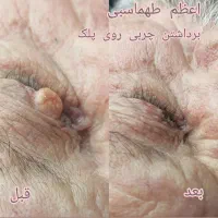 خدمات تخصصی زیبایی پوست ومو (اعظم طهماسبی)|خدمات آرایشگری و زیبایی|ایذه, |دیوار