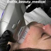 رنت دستگاه هایفو