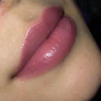 پیرسینگ حرفه ای وتزریق ژل هرسی سی از 550