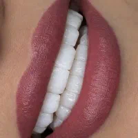 دندان پزشکی/کامپوزیت/روکش