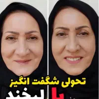 دندان مصنوعی ایتالیایی کامل ۱۵ میلیون بدون بیمه|خدمات آرایشگری و زیبایی|شیراز, کوشک میدان|دیوار