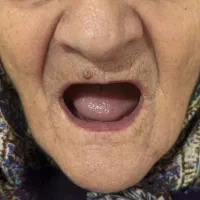 دندان مصنوعی + دندانسازی|خدمات آرایشگری و زیبایی|تهران, شمشیری|دیوار