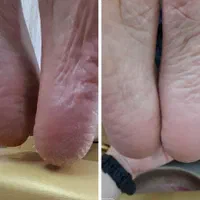 پدیکور تخصصی  و فشیال فردیس|خدمات آرایشگری و زیبایی|فردیس, فردیس|دیوار