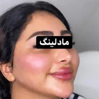 جشنواره ویژه ژل و بوتاکس|خدمات آرایشگری و زیبایی|اردبیل, |دیوار