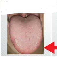 تشخیص مزاج و بیماری‌ها فقط و فقط با عکس زبان