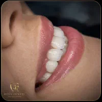 بیا کامپوزیت کن پیش پرداخت کم دندانپزشکی عصب‌ کشی