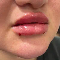 خدمات ژل و بوتاکس