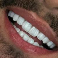 خدمات تخصصی زیبایی دندان