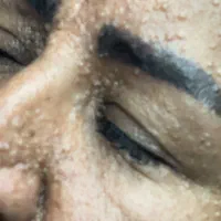 ابرسانی عمیق پوست به صورت تزریقی فقط ۱۴۰۰|خدمات آرایشگری و زیبایی|یاسوج, |دیوار