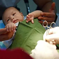 ختنه بادستگاه پیشرفته و کلیه خدمات پرستاری در منزل|خدمات آرایشگری و زیبایی|زابل, |دیوار