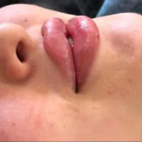 جشنواره خدمات حرفه ای درمان پوست و مو|خدمات آرایشگری و زیبایی|بستان آباد, |دیوار