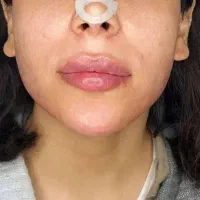 *جشنواره * تخفیف کلینیک زیبایی|خدمات آرایشگری و زیبایی|قرچک, شهرک طلائیه|دیوار