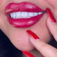 کامپوزیت. لمینت. ایمپلنت. روکش.عصب کشی