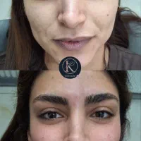 شروع جشنواره پاییز