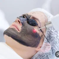 لیزر روشن کننده پوست و پاک کردن تتو