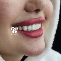 مطب دندانپزشکی طرف قرارداد با بیمه های تکمیلی