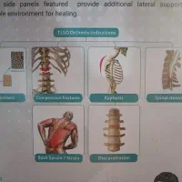 کمربند طبی tlso (ortino) اصلی|کیف، کفش، کمربند|مشهد, شهرک رازی (شهرک غرب)|دیوار