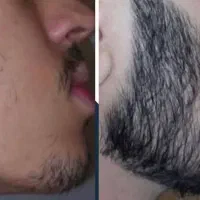 کوسه نباش