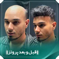 پروتزمو و ترمیم مو و تعمیرات و فروش|آرایشی، بهداشتی، درمانی|تهران, تهرانپارس غربی|دیوار