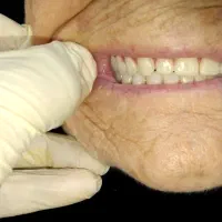 دندان مصنوعی/دندانسازی