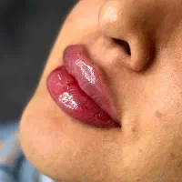 کلینیک پوست و زیبایی باراک