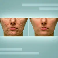 روتوش و ریتاچ حرفه ای عکس