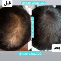 شامپو گیاهی درمانی
