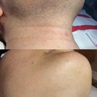 خانه لیزر صدراتضمینی|خدمات آرایشگری و زیبایی|صدرا-فارس, فاز ۱|دیوار