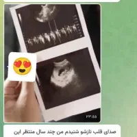 بارداری|آرایشی، بهداشتی، درمانی|اردبیل, |دیوار