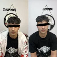 خدمات زیبایی در کلینیک لومریا Lumeria