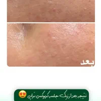 فیشال وپاکسازی پوست فقط ۴۹۹ت