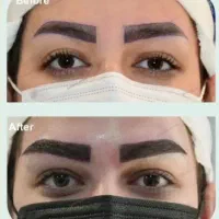 تخفیف کلینیک ژل بوتاکس نخ|خدمات آرایشگری و زیبایی|یاسوج, |دیوار