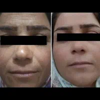 با ما 10سال جون تر شو