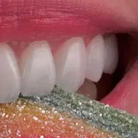 کامپوزیت دندان با چک . اقساط دندانپزشکی . تخفیفات|خدمات آرایشگری و زیبایی|تهران, صادقیه|دیوار