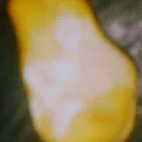 انواع سنگ موکل دار و شهاب سنگ