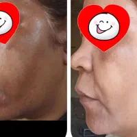 کرم روشن کننده‌ی طبیعی صورت + همراه عکس قبل و بعد|آرایشی، بهداشتی، درمانی|تهران, اوقاف|دیوار