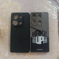 قاب شیاومی ردمی نوت 14s