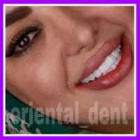 دندانپزشکی اقتصادی/کامپوزیت دندان/عصبکشی/ترمیم|خدمات آرایشگری و زیبایی|تهران, میدان ولیعصر|دیوار